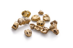 To sell dental gold in Freiburg to Edelmetalle direkt To sell dental gold in Freiburg to Edelmetalle direkt